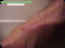 blessures-04.jpg (37535 octets)