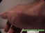 blessures-05.jpg (40302 octets)