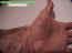 blessures-07.jpg (35865 octets)