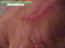 blessures-08.jpg (40348 octets)