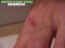 blessures-09.jpg (37843 octets)