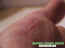 blessures-10.jpg (41004 octets)